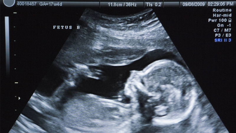 Fetal Medicine