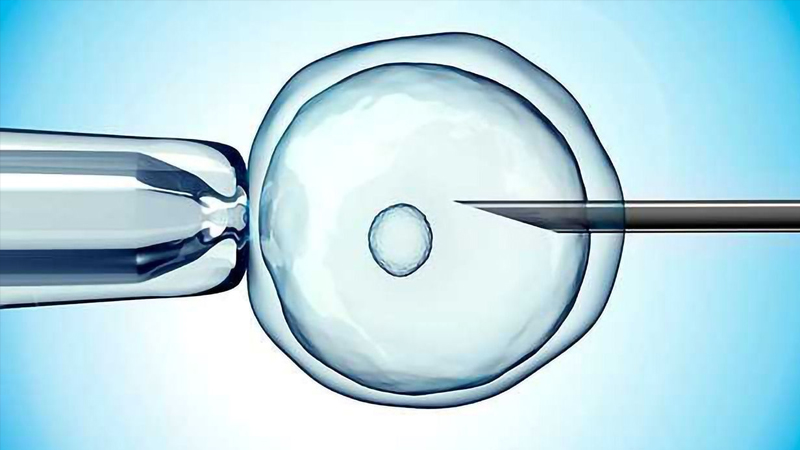 Infertility