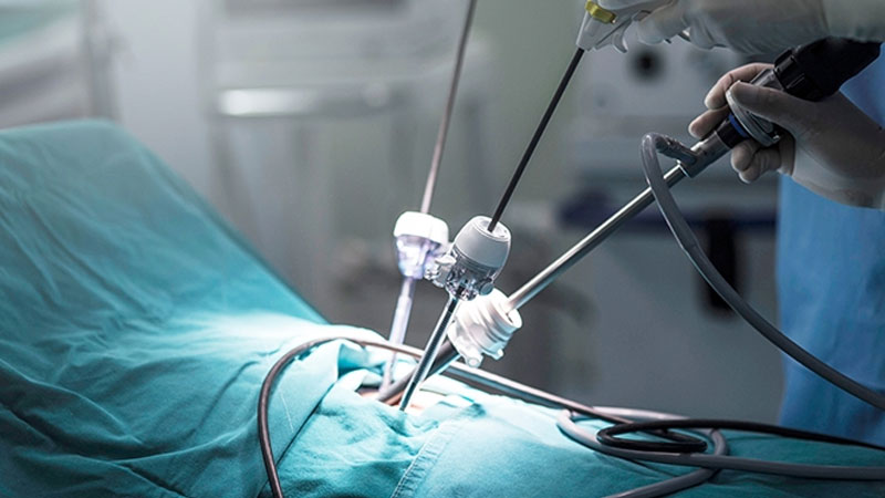 Laparoscopy